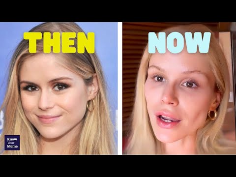 Starlight Looks Different... Erin Moriarty Selfies Spark Cosmetic Surgery Rumors and Memes