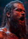 bray wyatt cause of death